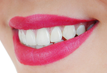 Eine lächelnde Frau mit weißen Zähnen.