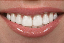 Eine lächelnde Frau mit weißen Zähnen.