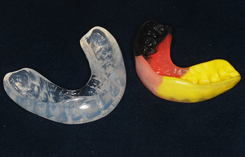 Eine transparente Zahnschiene und eine schwarz-rot-gelbe Zahnschiene nebeneinander auf einem schwarzen Tisch.